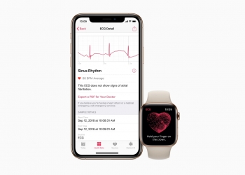 增心电图功能！watchOS 7.4下周更新惟未包括大马