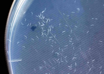 检测新科技？“线虫之鼻”筛检胰腺癌准确性高