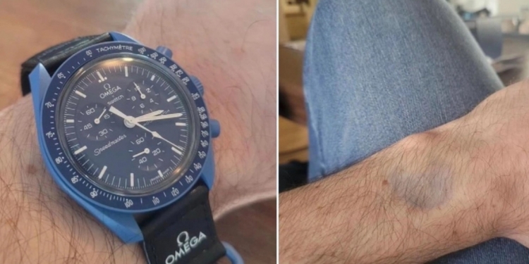 全民疯抢的登月表竟然掉色？来听听Swatch怎么说！